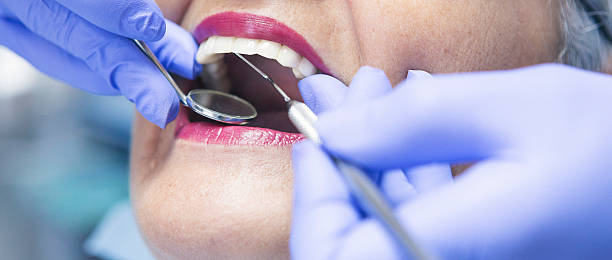 Best Emergency Broken Tooth Repair in Estacada, OR